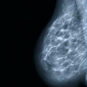 Пленка для маммографических исследований CEA MA Plus